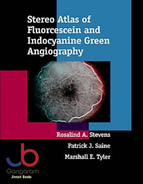 Stereo Atlas of Fluorescein and Indocyanine Green Angiography