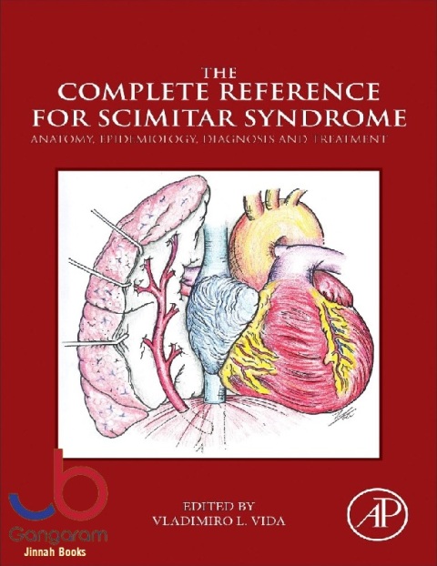 The Complete Reference for Scimitar Syndrome Anatomy, Epidemiology, Diagnosis and Treatment