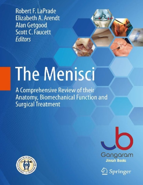 The Menisci A Comprehensive Review of their Anatomy, Biomechanical Function and Surgical Treatment