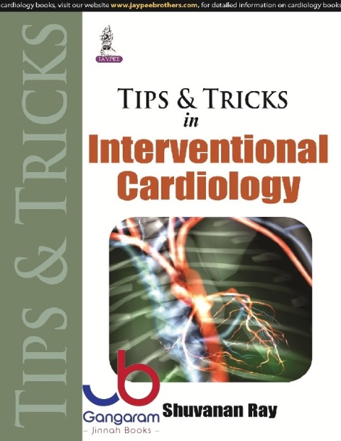 Tips and Tricks in Interventional Cardiology (Tips & Tricks)