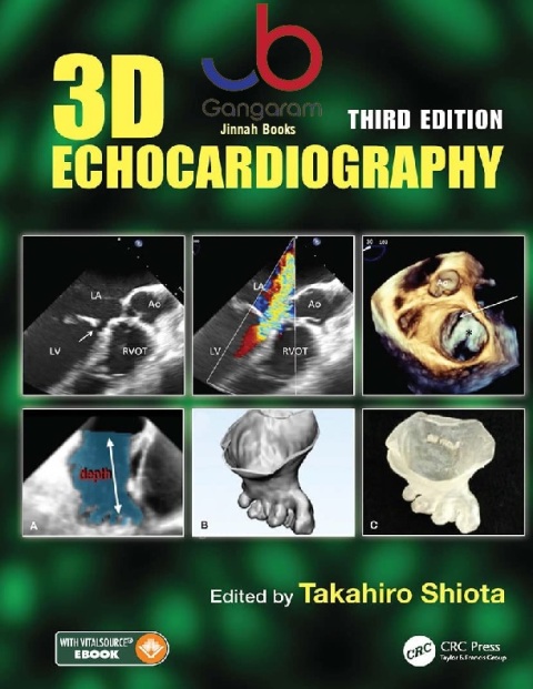 3D Echocardiography.