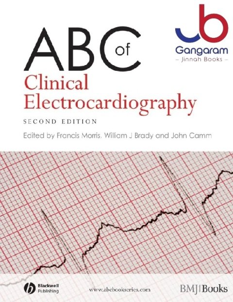 ABC of Clinical Electrocardiography