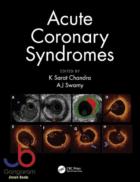 Acute Coronary Syndromes.
