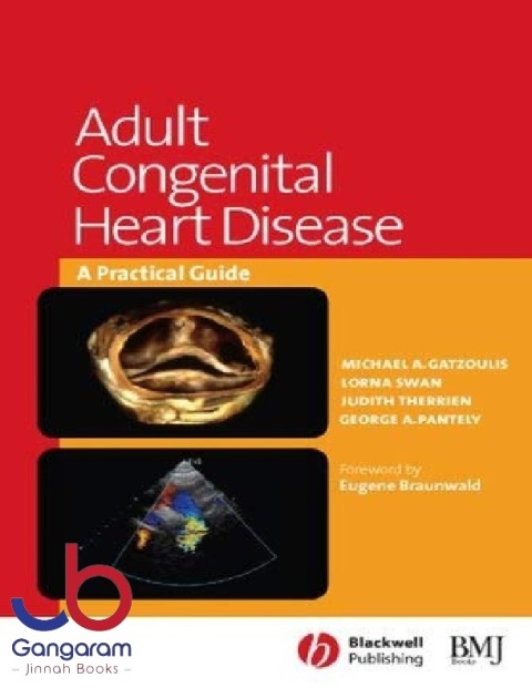 Adult Congenital Heart Disease A Practical Guide