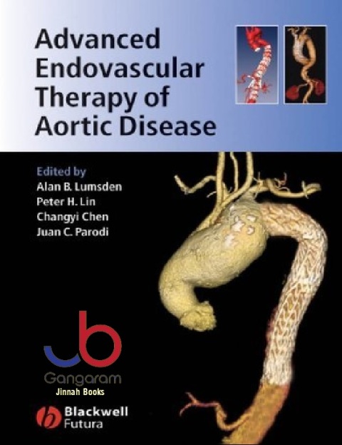 Advanced Endovascular Therapy of Aortic Disease