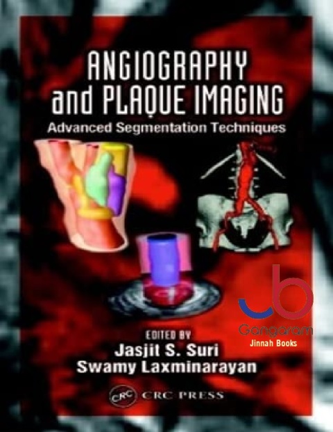 Angiography and Plaque Imaging Advanced Segmentation Techniques (Biomedical Engineering)