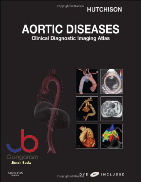 Aortic Diseases Clinical Diagnostic Imaging Atlas with DVD