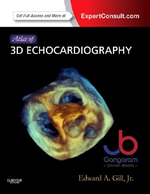 Atlas of 3D Echocardiography Expert Consult – Online and Print