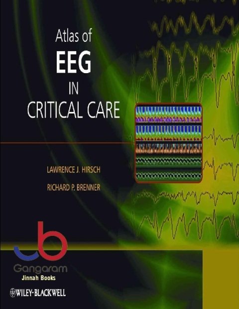 Atlas of EEG in Critical Care 1st Edition
