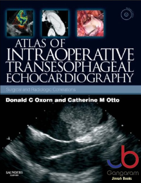 Atlas of Intraoperative Transesophageal Echocardiography Surgical and Radiologic Correlations, Text with DVD