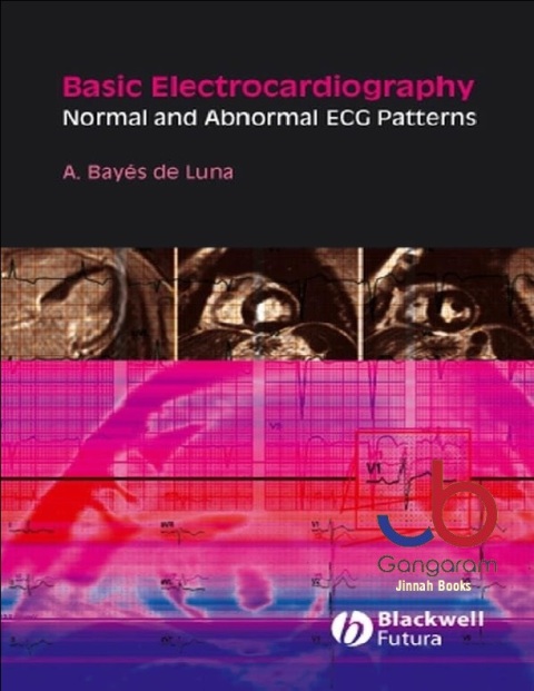 Basic Electrocardiography Normal and Abnormal ECG Patterns.