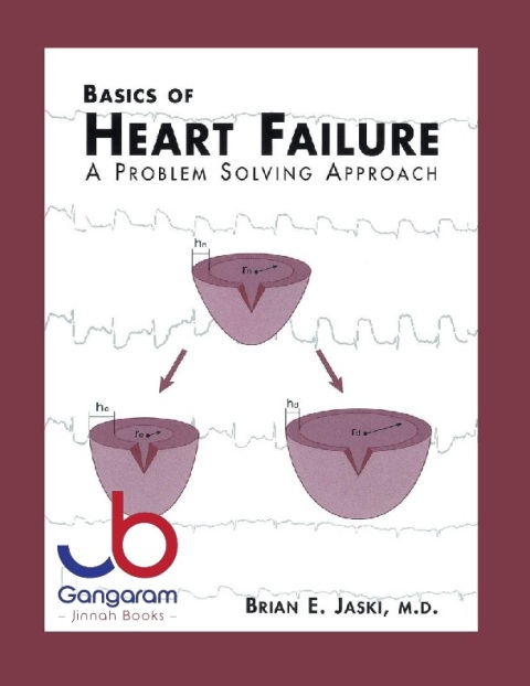 Basics of Heart Failure A Problem Solving Approach 228 (Developments in Cardiovascular Medicine, 228)