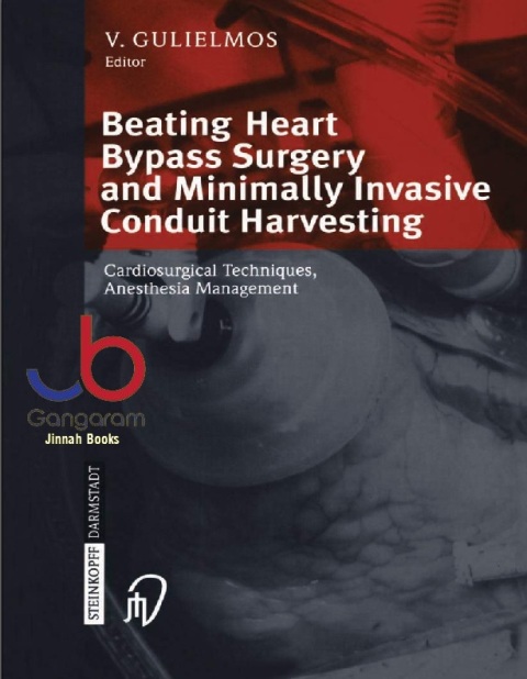 Beating Heart Bypass Surgery and Minimally Invasive Conduit Harvesting Cardiosurgical Techniques, Anesthesia Management