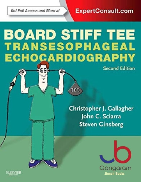 Board Stiff TEE Transesophageal Echocardiography ExpertConsult Online and Print