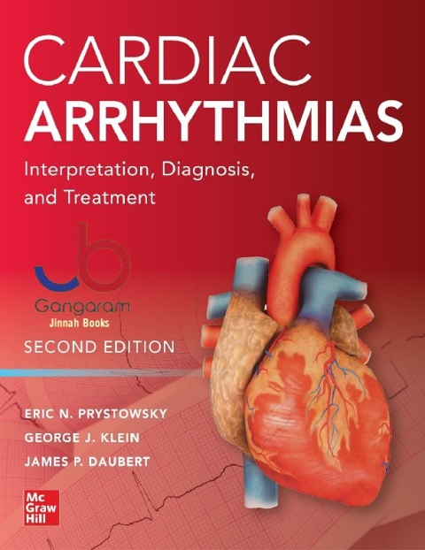 Cardiac Arrhythmias Interpretation, Diagnosis and Treatment, Second Edition