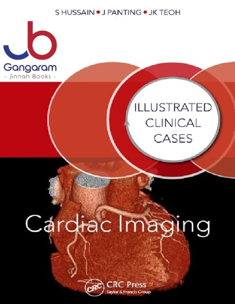 Cardiac Imaging Illustrated Clinical Cases