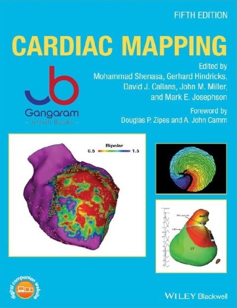 Cardiac Mapping