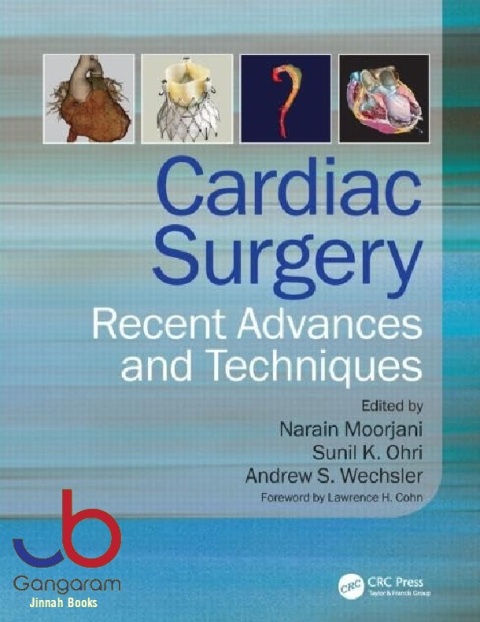 Cardiac Surgery Recent Advances and Techniques