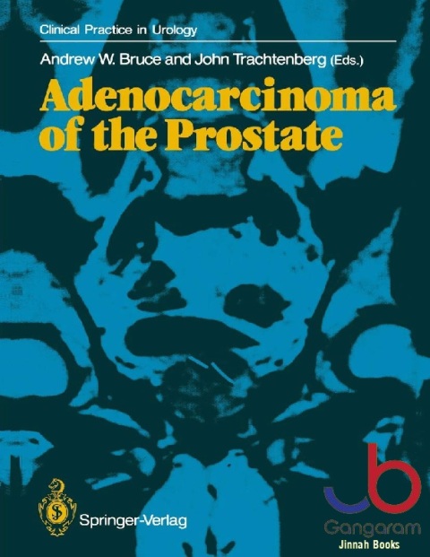 Adenocarcinoma of the Prostate (Clinical Practice in Urology)
