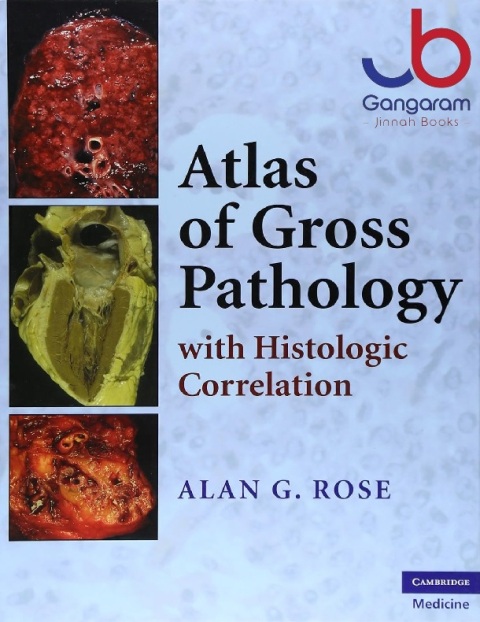 Atlas of Gross Pathology With Histologic Correlation