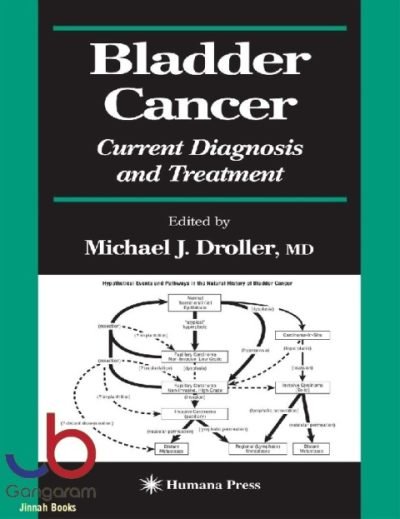 Bladder Cancer: Current Diagnosis and Treatment