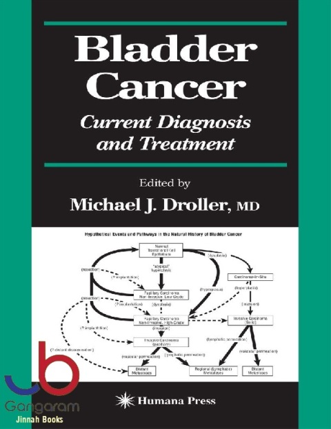 Bladder Cancer Current Diagnosis and Treatment (Current Clinical Urology)