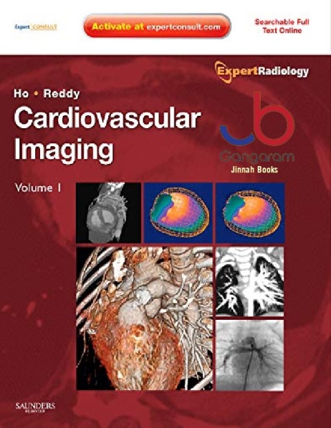 Cardiovascular Imaging, 2-Volume Set Expert Radiology Series