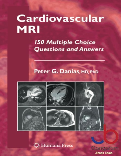 Cardiovascular MRI 150 Multiple-Choice Questions and Answers (Contemporary Cardiology)