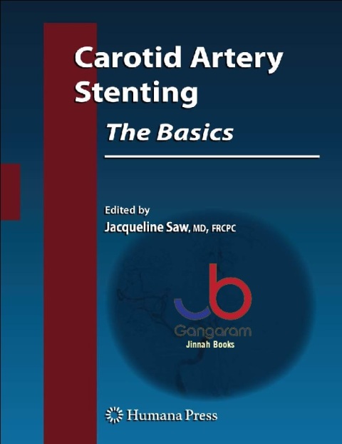 Carotid Artery Stenting The Basics (Contemporary Cardiology)