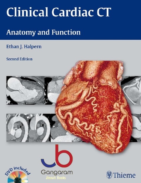 Clinical Cardiac CT Anatomy and Function