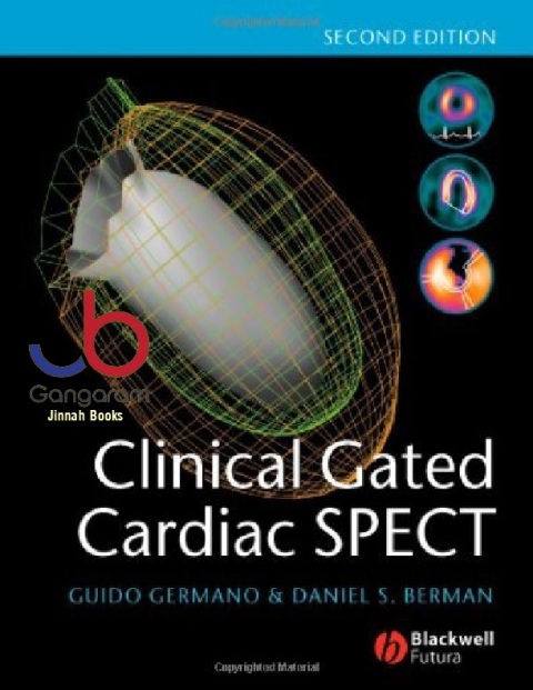 Clinical Gated Cardiac SPECT