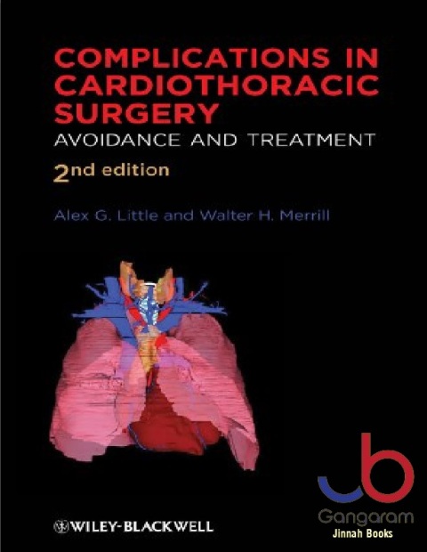 Complications in Cardiothoracic Surgery Avoidance and Treatment