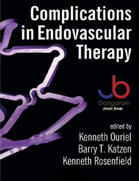Complications in Endovascular Therapy 1st Edition