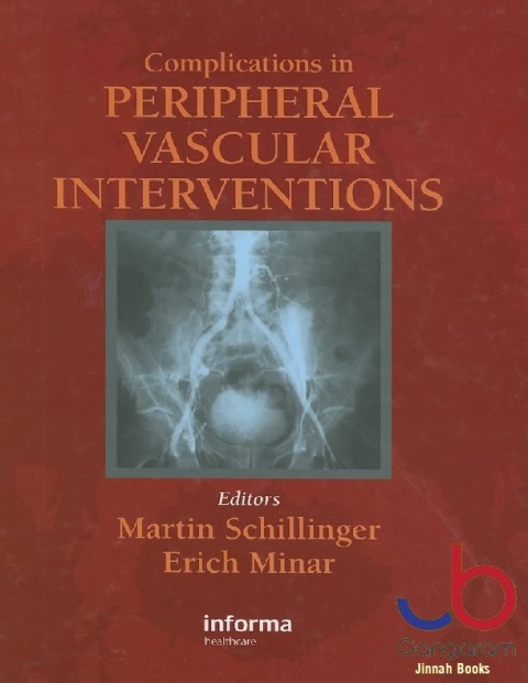 Complicatons in Peripheral Vascular Interventions