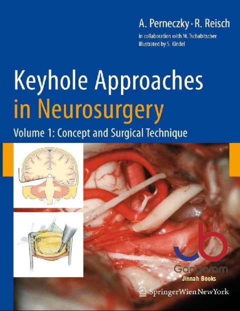 Concept and Surgical Technique (Volume 1) (Key Hole Approaches in Neurosurgery)