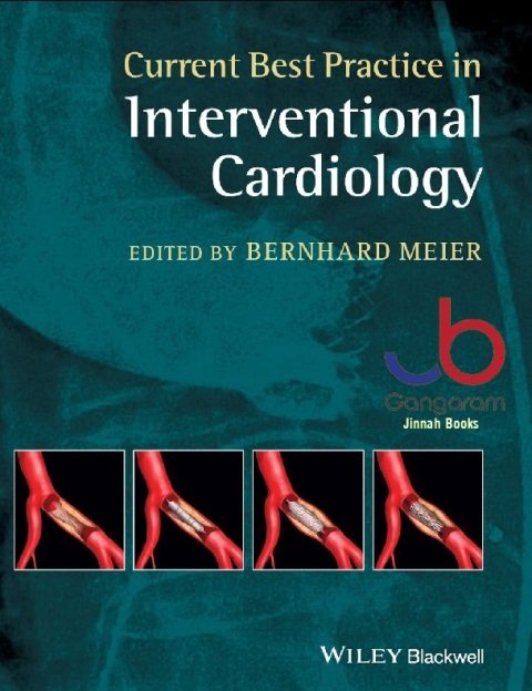 Current Best Practice in Interventional Cardiology