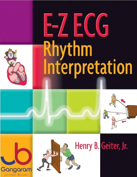 E-Z ECG Rhythm Interpretation