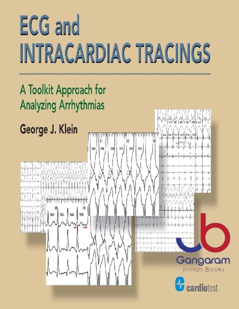 ECG and Intracardiac Tracings A Toolkit Approach for Analyzing Arrhythmias