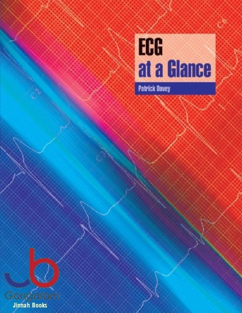 ECG at a Glance