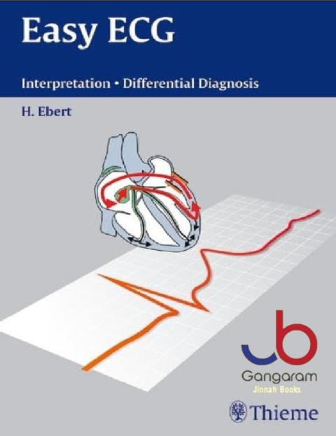 Easy ECG Interpretation - Differential Diagnosis Interpretation Differential Diagnoses