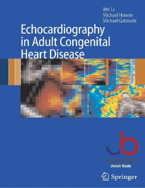 Echocardiography in Adult Congenital Heart Disease