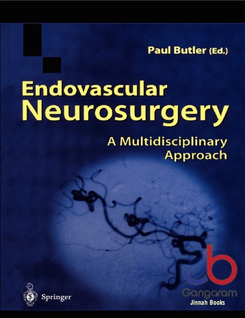 Endovascular Neurosurgery A Multidisciplinary Approach