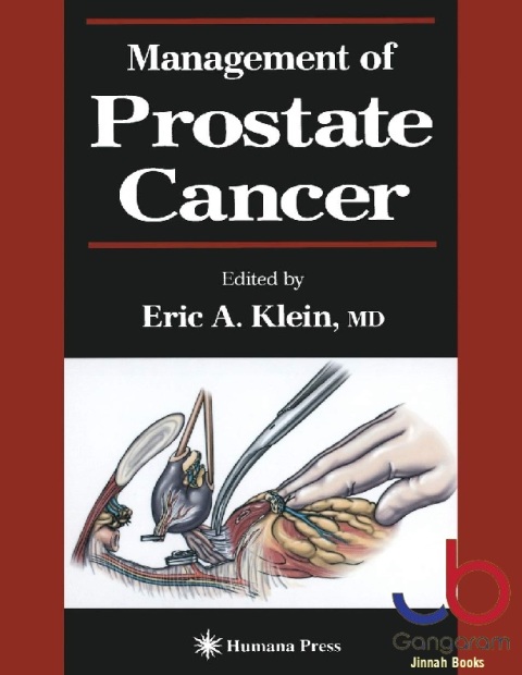 Management of Prostate Cancer (Current Clinical Urology)