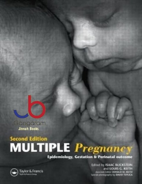 Multiple Pregnancy Epidemiology, Gestation, and Perinatal Outcome