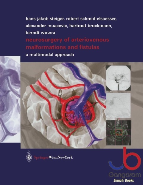 Neurosurgery of Arteriovenous Malformations and Fistulas A Multimodal Approach