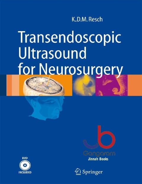 Transendoscopic Ultrasound for Neurosurgery