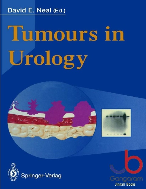 Tumours in Urology