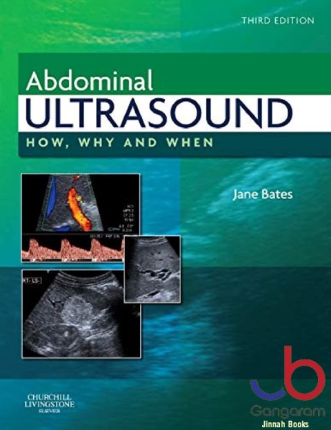 Abdominal Ultrasound How, Why and When