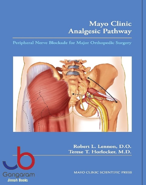 Mayo Clinic Analgesic Pathway Peripheral Nerve Blockade for Major Orthopedic Surgery