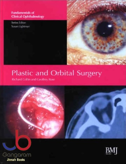Plastic and Orbital Surgery.